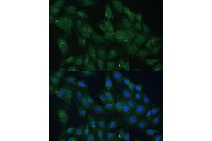 Immunofluorescence analysis of C6 cells using  Polyclonal Antibody (ABIN7265476) at dilution of 1:100 (40x lens). (ARL1 anticorps  (AA 62-181))