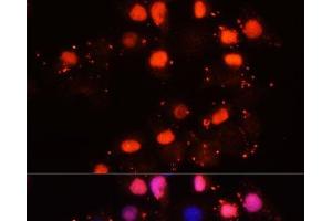 Immunofluorescence analysis of HeLa cells using HMGB2 Polyclonal Antibody at dilution of 1:100.