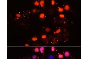 Immunofluorescence analysis of HeLa cells using HMGB2 Polyclonal Antibody at dilution of 1:100. (HMGB2 anticorps)