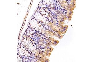 Immunohistochemistry of paraffin embedded mouse colon using SRP14 (ABIN7075596) at dilution of 1:300 (400x lens)