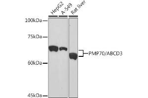 Western blot analysis of extracts of various cell lines, using PMP70/ Rabbit mAb (ABIN1683181, ABIN3018647, ABIN3018648 and ABIN7101638) at 1:1000 dilution.