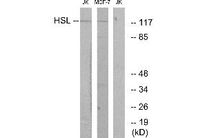 Immunohistochemistry analysis of paraffin-embedded human tonsil tissue using HSL (Ab-552) antibody. (LIPE anticorps  (Ser552))