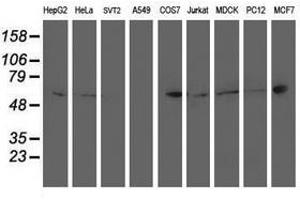 Image no. 5 for anti-Protein tyrosine Phosphatase, Non-Receptor Type 1 (PTPN1) antibody (ABIN1500496)