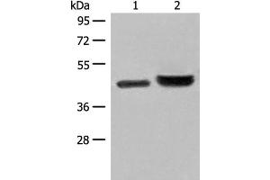 Western blot analysis of 231 cell and Human fetal liver tissue lysates using INPP1 Polyclonal Antibody at dilution of 1:500 (INPP1 anticorps)