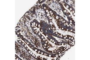 Immunohistochemical staining of human colon with COG5 polyclonal antibody  shows strong cytoplasmic positivity in granular pattern in glandular cells. (COG5 anticorps)