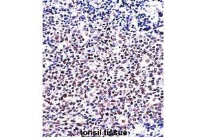 Immunohistochemistry (IHC) image for anti-Nuclear Factor of Activated T-Cells, Cytoplasmic, Calcineurin-Dependent 1 (NFATC1) antibody (ABIN2997610) (NFATC1 anticorps)