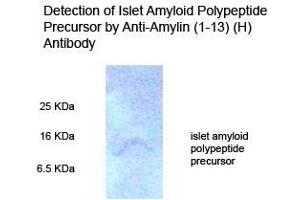 Rat pancreas tissue homogenate on 15 % Tricine_PAGE (reduce condition) Primary Antibody 1:500 (Amylin/DAP anticorps  (AA 1-13))
