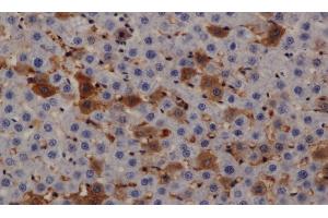 Immunohistochemistry of paraffin-embedded Rat liver using PRKD3 Polyclonal Antibody at dilution of 1:200 (PRKD3 anticorps)