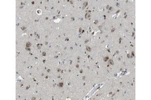 ABIN6266846 at 1/100 staining human brain tissue sections by IHC-P. (TFAM anticorps  (Internal Region))