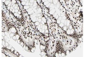 ABIN6266744 at 1/100 staining human colon tissue sections by IHC-P.