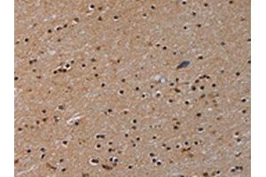 anti-Poly (ADP-Ribose) Polymerase Family, Member 8 (PARP8) antibody