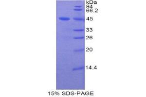 SDS-PAGE (SDS) image for Lipocalin 8 (LCN8) (AA 25-176) protein (His tag,GST tag) (ABIN2123186) (LCN8 Protein (AA 25-176) (His tag,GST tag))