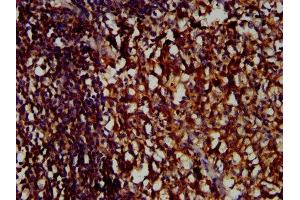 IHC image of ABIN7158264 diluted at 1:400 and staining in paraffin-embedded human tonsil tissue performed on a Leica BondTM system.