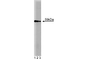 Western Blotting (WB) image for anti-V-Akt Murine Thymoma Viral Oncogene Homolog 1 (AKT1) antibody (ABIN968218) (AKT1 anticorps)