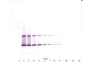 Image no. 1 for anti-Ciliary Neurotrophic Factor (CNTF) antibody (ABIN1497554)