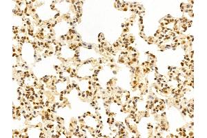 ABIN6266019 and ABIN6273346 at 1/100 staining Rat lung tissue by IHC-P.