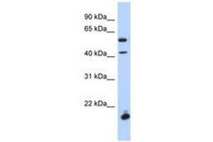 Image no. 1 for anti-Developing Brain Homeobox 1 (DBX1) (AA 248-297) antibody (ABIN6741082) (DBX1 anticorps  (AA 248-297))
