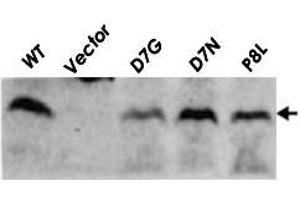 Detection of RuvC (19kD) proteins in the cell extracts of E. (RuvC anticorps)