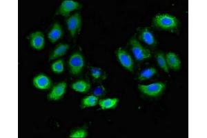 Immunofluorescent analysis of A549 cells using ABIN7163717 at dilution of 1:100 and Alexa Fluor 488-congugated AffiniPure Goat Anti-Rabbit IgG(H+L) (PLXND1 anticorps  (AA 1-222))