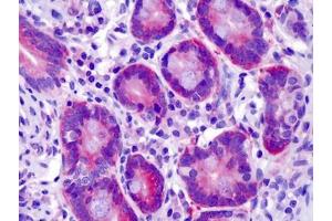 Human Small Intestine: Formalin-Fixed, Paraffin-Embedded (FFPE)