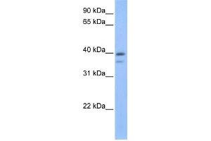 WB Suggested Anti-VPS26B Antibody Titration: 0. (VPS26B anticorps  (C-Term))