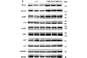 PSMD1 and PSMD2 regulate the expression level of fatty acids (FAs) and lipid synthesis-related genes. (MAPK14 anticorps  (pThr180, pTyr182))