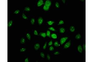 Immunofluorescence staining of A549 cells with ABIN7161270 at 1:100, counter-stained with DAPI. (Neurofibromin 1 anticorps  (AA 655-892))