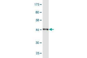 Western Blot detection against Immunogen (48. (RAB7L1 anticorps  (AA 1-203))