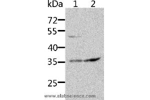 Western blot analysis of HT-29 and 231 cell, using SOCS1 Polyclonal Antibody at dilution of 1:1700 (SOCS1 anticorps)
