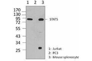 Western Blotting (WB) image for anti-Signal Transducer and Activator of Transcription 5A (STAT5A) antibody (ABIN2666295) (STAT5A anticorps)