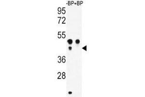 Western blot analysis of ATF4 antibody pre-incubated without (Lane 1) and with (2) blocking peptide in WiDr lysate (ATF4 anticorps  (AA 220-252))