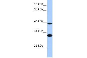 WB Suggested Anti-UBE2F Antibody Titration: 0. (UBE2F anticorps  (N-Term))