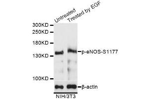 Western blot analysis of extracts of NIH/3T3 cells,using Phospho-eNOS-S1177 antibody (ABIN5995597) at 1/1000 dilution. (ENOS anticorps  (pSer1177))