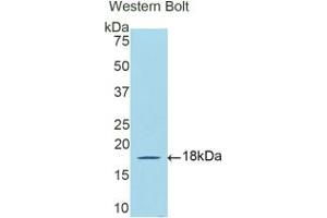 Western blot analysis of the recombinant protein. (DBR1 anticorps  (AA 243-372))