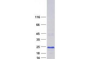 Validation with Western Blot