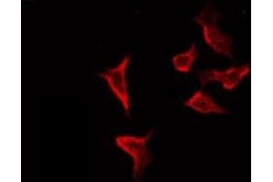 ABIN6274119 staining COLO205 by IF/ICC. (TRIM3 anticorps  (Internal Region))