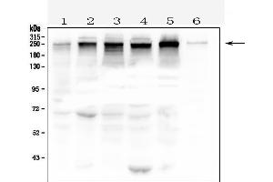 Western blot analysis of TJP1 using anti- TJP1 antibody . (TJP1 anticorps  (AA 1178-1527))