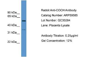 WB Suggested Anti-COCH  Antibody Titration: 0.