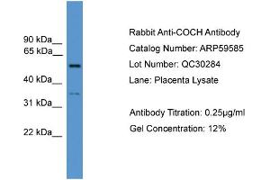WB Suggested Anti-COCH  Antibody Titration: 0. (COCH anticorps  (N-Term))