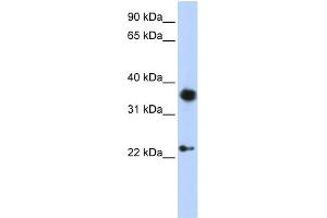 WB Suggested Anti-EN1 Antibody Titration:  0. (EN1 anticorps  (C-Term))
