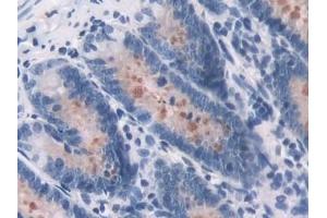 Detection of OAS1 in Rat Colon Tissue using Polyclonal Antibody to 2',5'-Oligoadenylate Synthetase 1 (OAS1) (OAS1 anticorps  (AA 139-358))