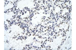 Rabbit Anti-KLHL26 antibody        Paraffin Embedded Tissue:  Human Lung cell   Cellular Data:  Epithelial cells of renal tubule  Antibody Concentration:   4. (KLHL26 anticorps  (C-Term))