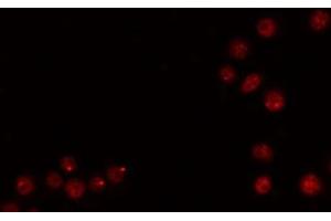 ABIN6269269 staining 293 by IF/ICC.