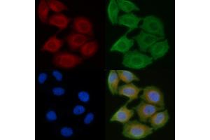 ABIN6258516 and ABIN6274735 staining Hela cells(45 min of heat-shock) by IF/ICC.