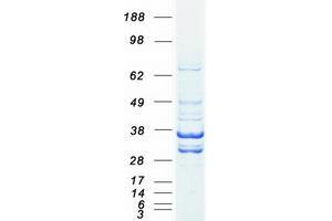 Validation with Western Blot