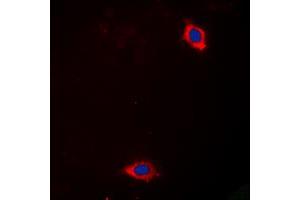 Immunofluorescent analysis of Laminin alpha 4 staining in Hela cells.