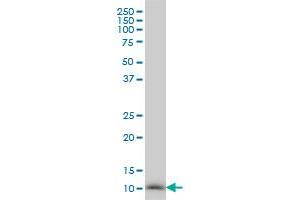 NDUFB3 monoclonal antibody (M01), clone 6C6 Western Blot analysis of NDUFB3 expression in HeLa .