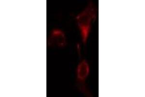 ABIN6275584 staining  A549 cells by IF/ICC. (SLC9A9 anticorps  (Internal Region))