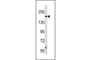 TSC2 Antibody (Center /) (ABIN1881944 and ABIN2843242) western blot analysis in Jurkat cell line lysates (35 μg/lane). (Tuberin anticorps  (AA 1364-1393))