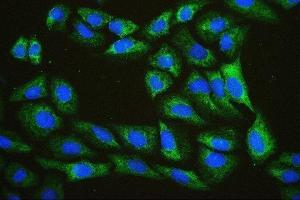 IF analysis of EIF4A using anti-EIF4A antibody (ABIN7601309). (EIF4A1 anticorps  (AA 32-406))